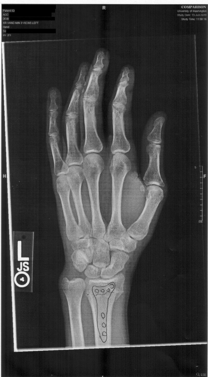 Javantea's hand x-ray